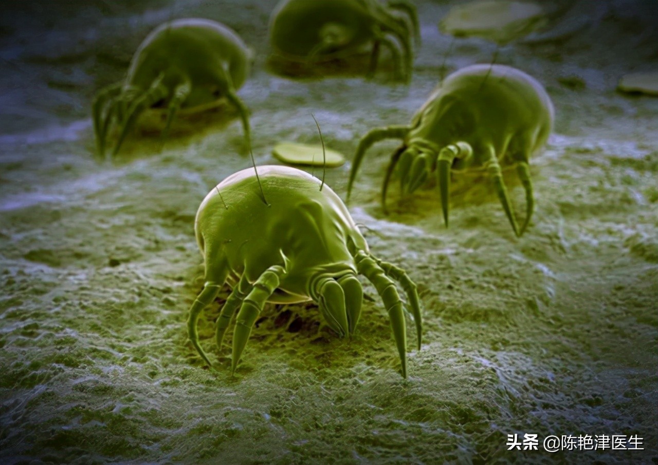 疥疮疥虫隧道图片(疥螨是什么) - 赤虎壹号