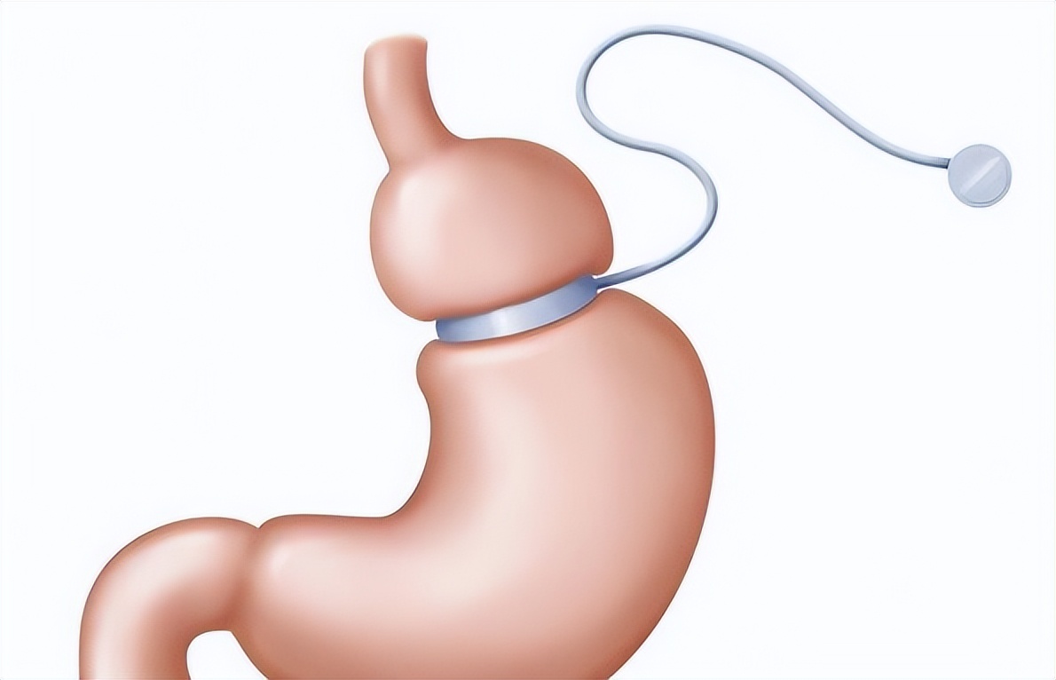 儿童胃肠功能紊乱怎么调理？哪些食物可以调理孩子肠胃异常