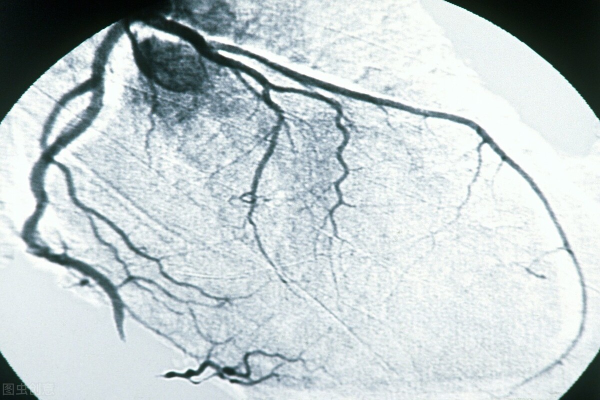 心脏不舒服，医生开的这些检查有没有必要做？到底是在查什么？