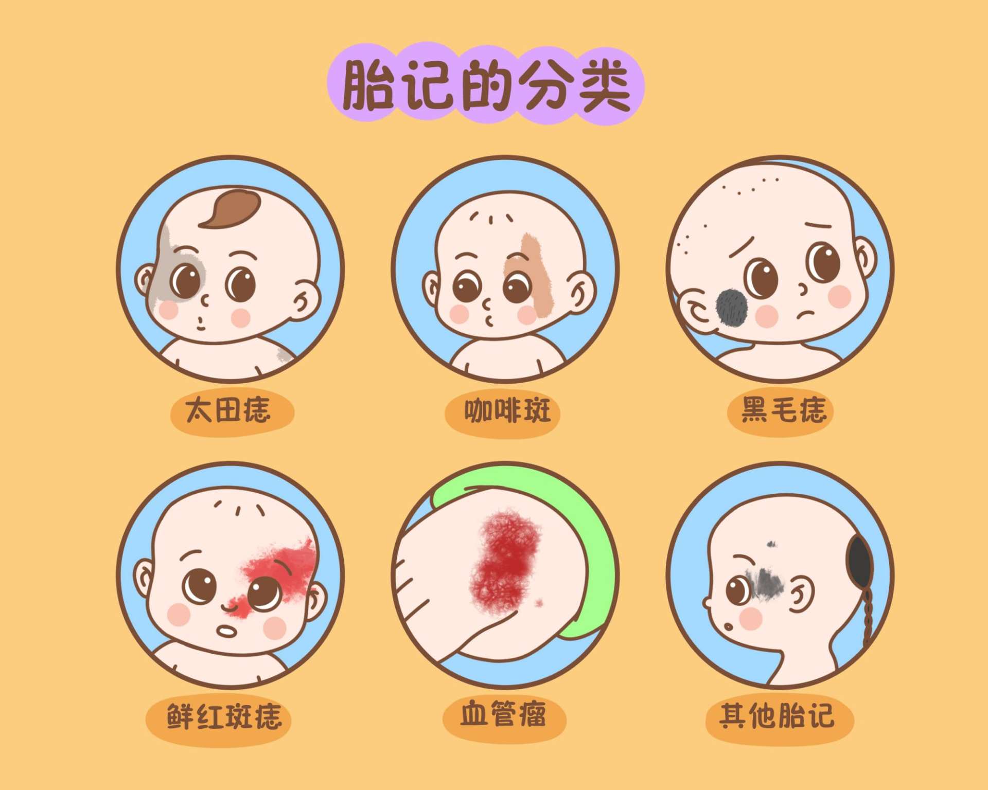 宝宝后背满是青色胎记,网友:这是被打了多少棍才下来的