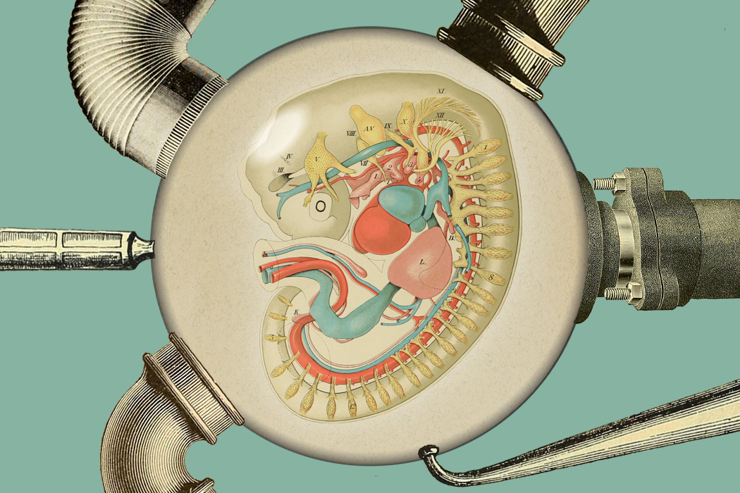 "人造子宫"是怎么孕育生命?