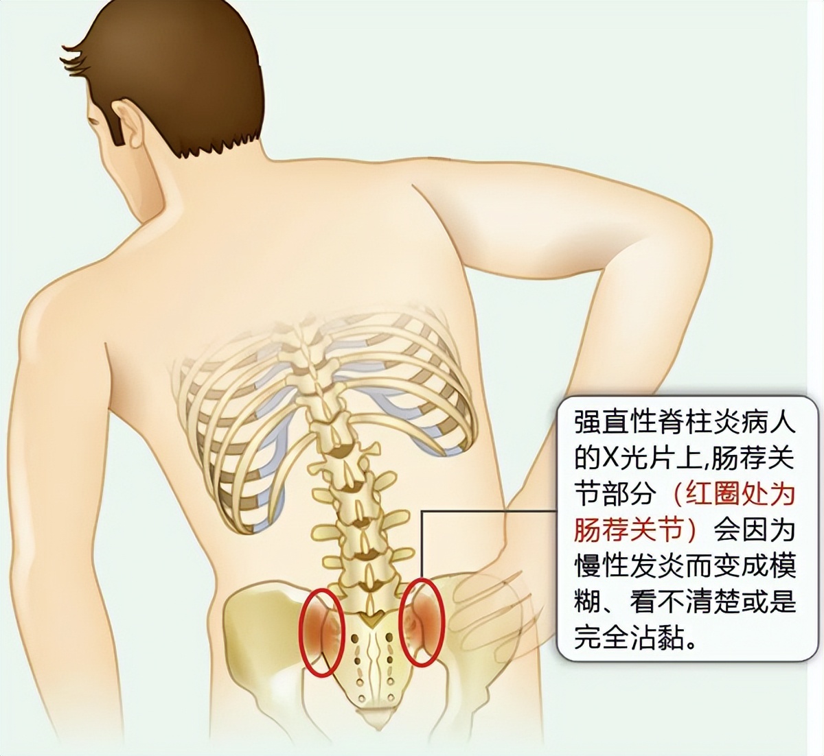 骶骨的位置图图片