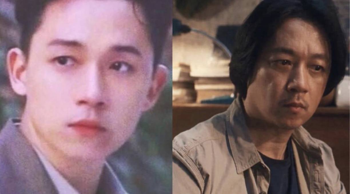 脸部肿成“馒头”，笑起来秒变“僵尸”，这些明星的脸到底咋了？