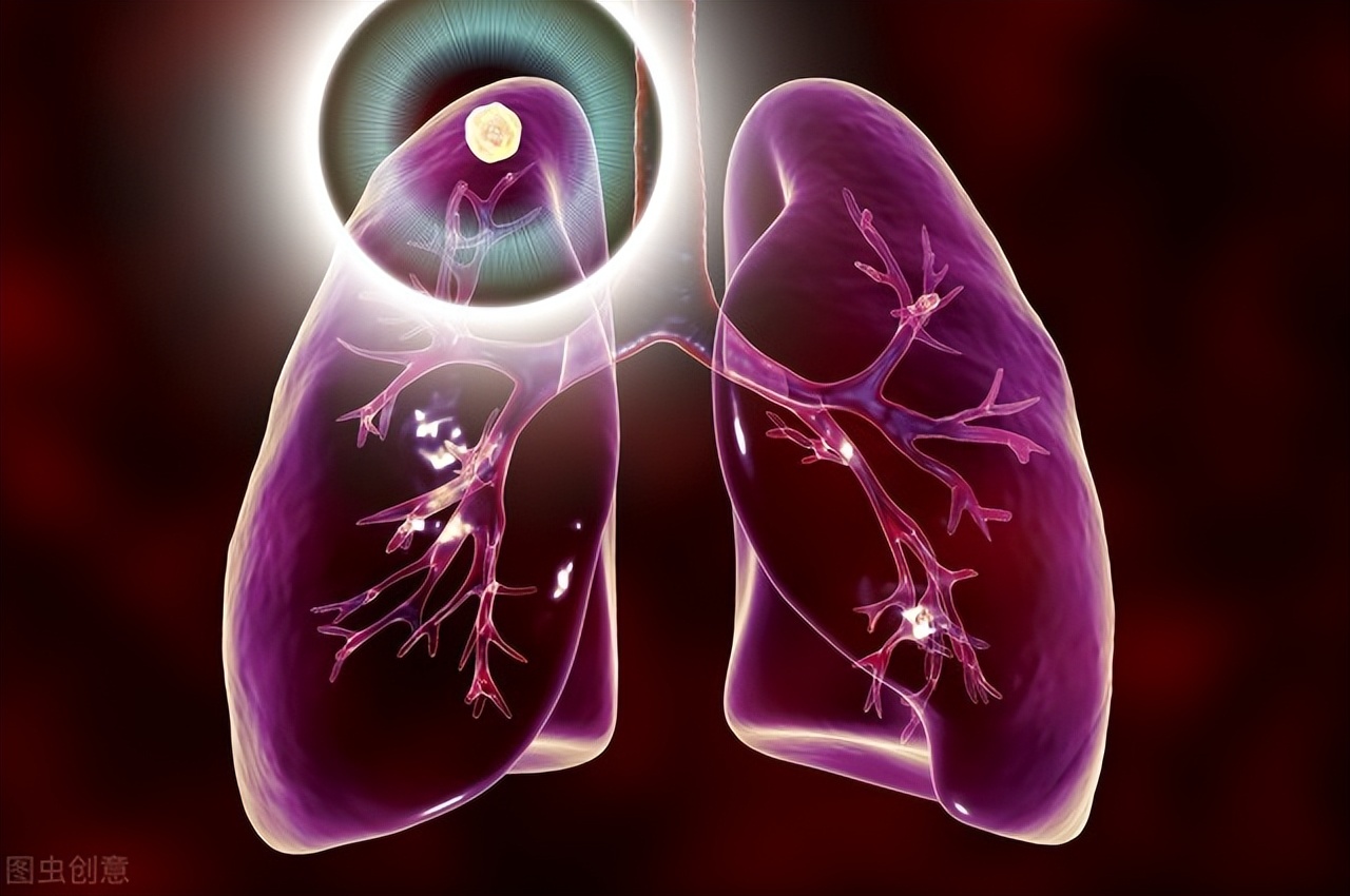 长期便秘和肝脏有什么关系，为什么很多肝病患者常常便秘