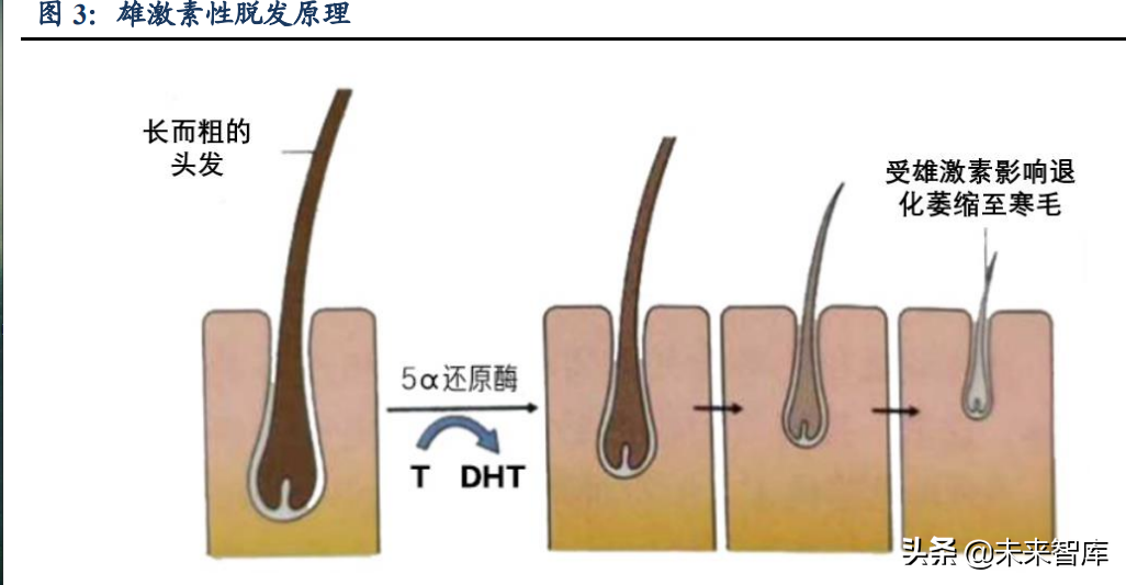 植发医疗行业深度研究：心系万千青丝，植发经济方兴未艾