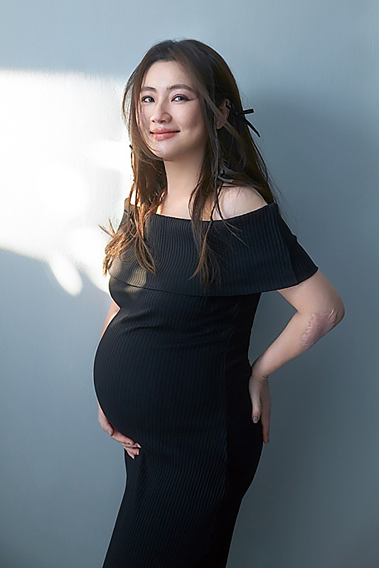 selina挺孕肚拍大片,晒手臂疤痕惹人心疼,因烧伤孕期水肿严重