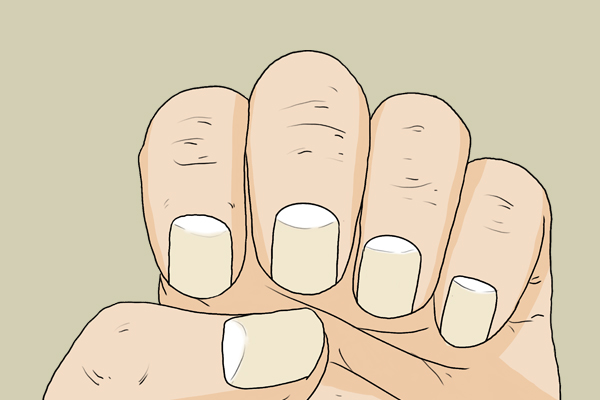 月牙是身体的“晴雨表”?指甲上的月牙、白点、竖纹代表什么？