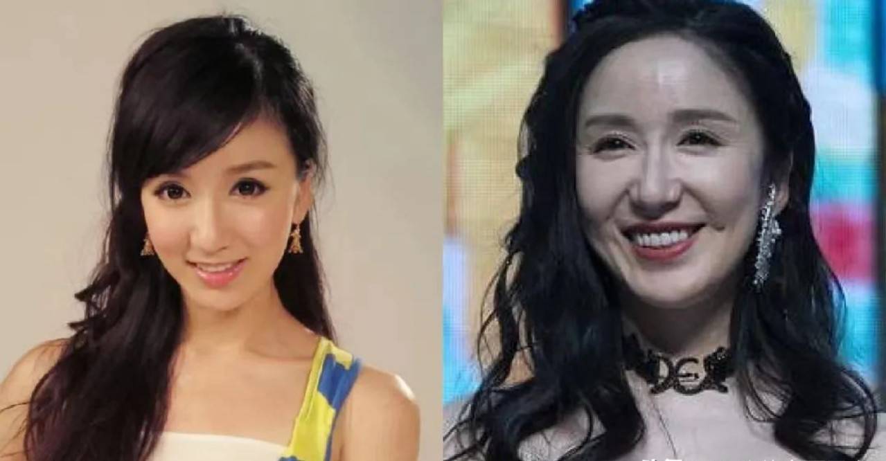 但从她整容后出现在镜头的图片来看,娄艺潇的医生似乎并不怎么有实力