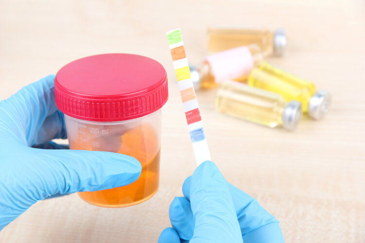 人尿可以喝吗？喝了会怎样？老实说：除了1种情况，否则不建议喝