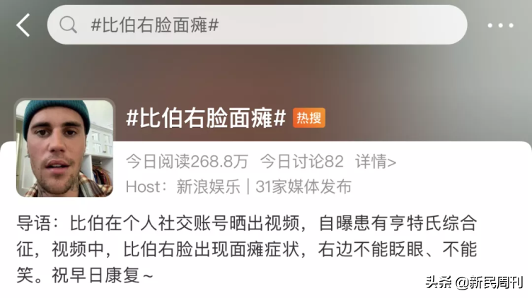 良医 | 比伯面瘫，这么好看的脸还能治好吗？