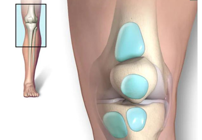 膝盖突然无征兆疼痛（膝盖无征兆疼痛可能是这4个原因）
