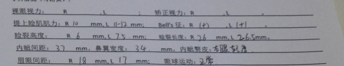 12月13日单侧上睑下垂修复，修复后我很满意和预期一致