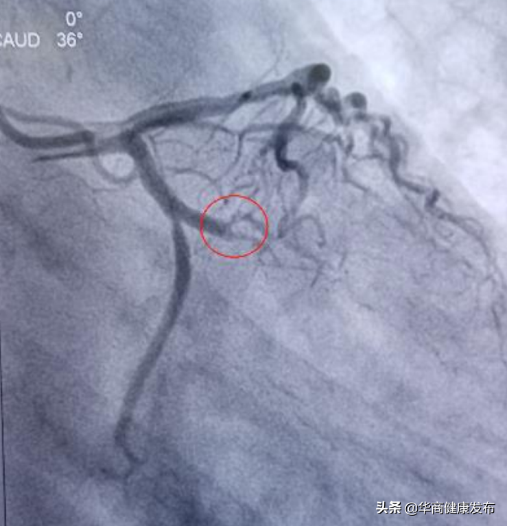 今天！他们终于凯旋归来！西安交大二附院援定点医院纪实