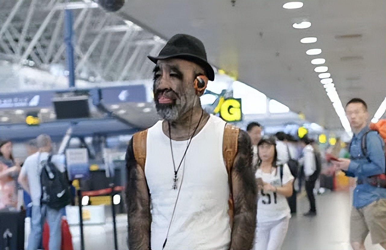 当年轰动一时的“毛孩”：42岁娶90后娇妻，生下一子未遗传长毛