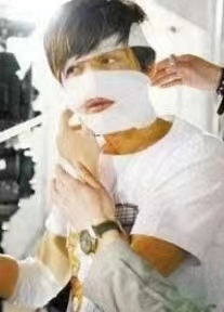 杨幂的眼角，阿娇的脸，明星脸上受伤、毁容，各个让人揪心