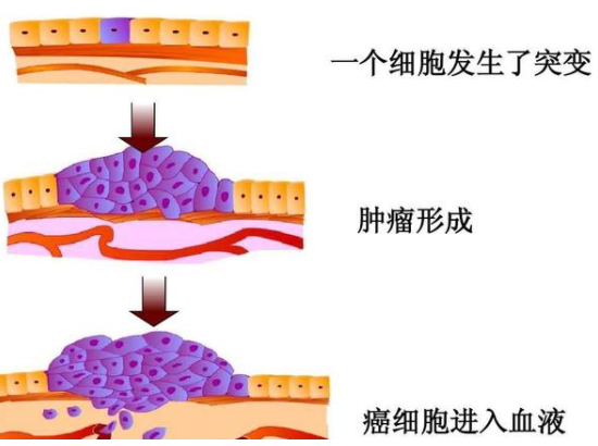 一两万的肿瘤基因检测，值不值得做？若非这3类人群，劝你再想想