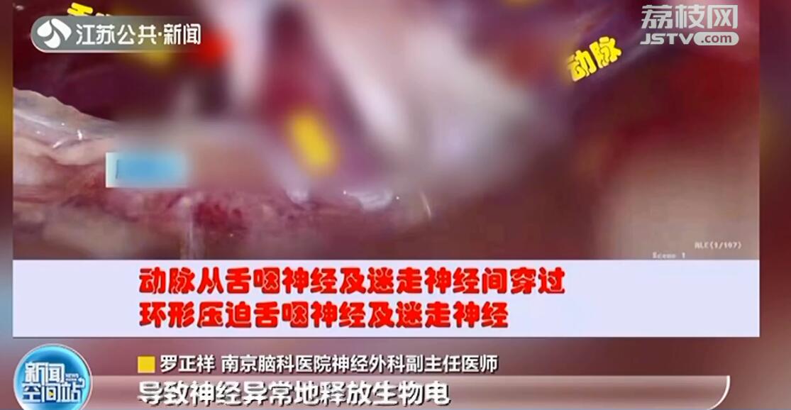 吃饭喝水像吞刀片一样疼！病因竟是脑部神经&ldquo;短路&rdquo;