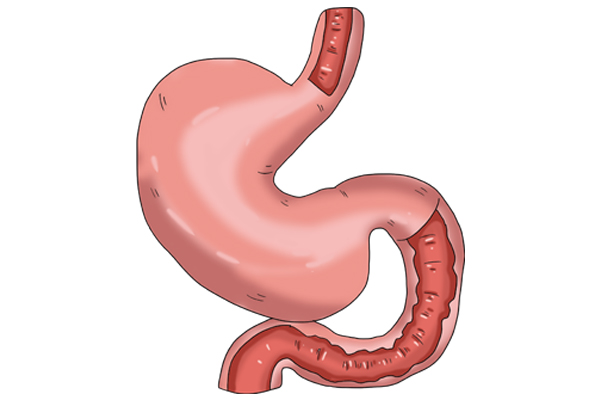 每天吃面条，究竟是胃病“发物”，还是“养胃佳品”？和你说清楚