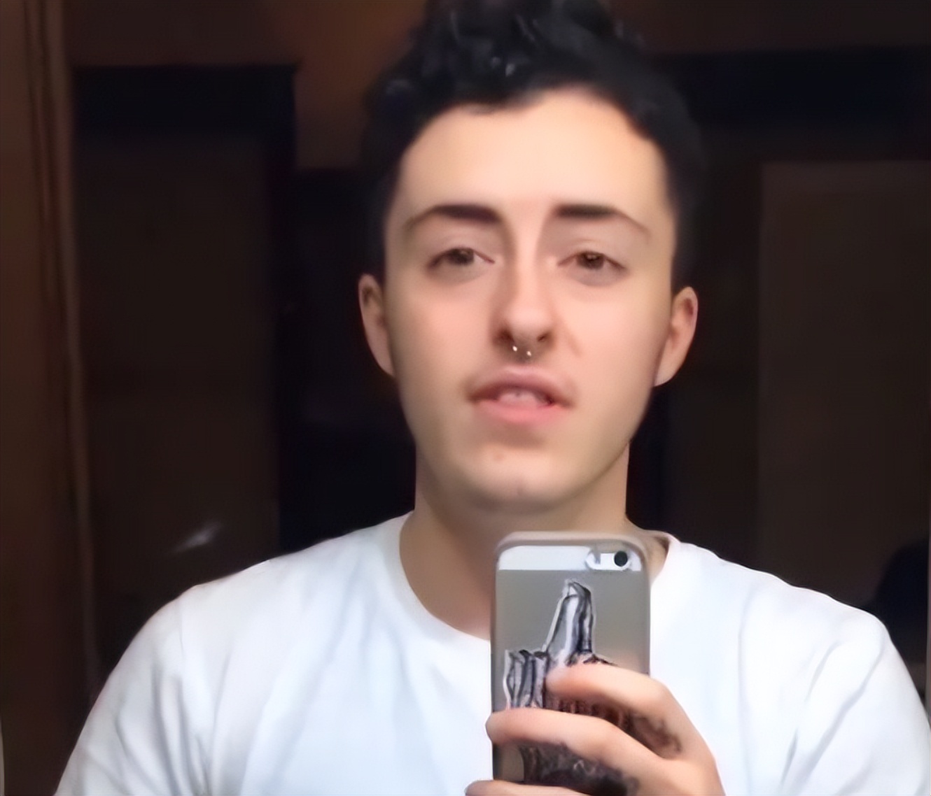 男变女手术隆胸过程(美国女子切除胸部,使用睾丸素变性成男,7年后,他