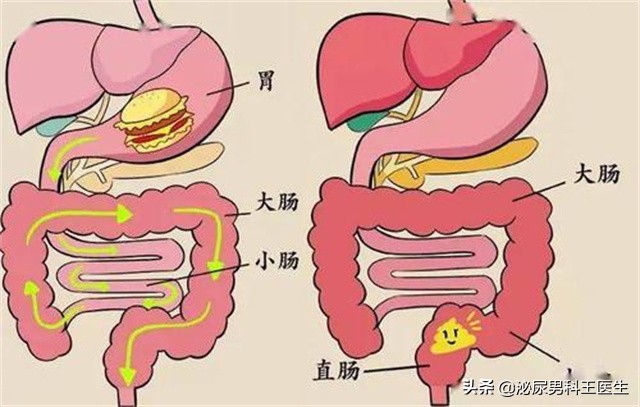 32歲小王每天大便兩三次,確診腸癌!3種大便異常是身體