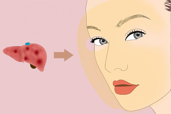 肝好不好，皮肤有反馈，若无“红黄黑”3种颜色，说明肝还可以