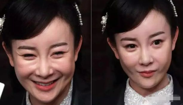 瘦到病态，动脸成瘾，切胃、剪肠齐上阵，内娱的畸形审美真可怕