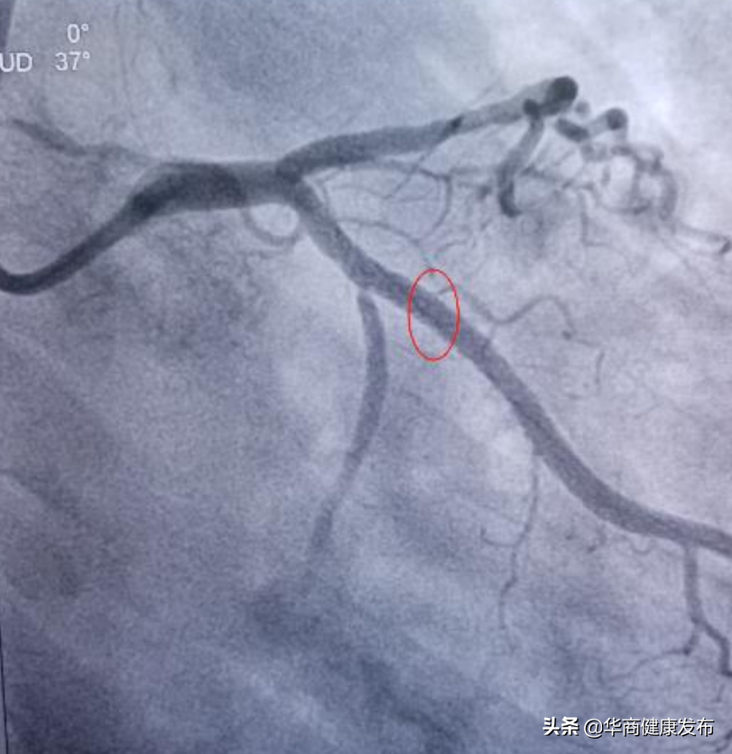 今天！他们终于凯旋归来！西安交大二附院援定点医院纪实