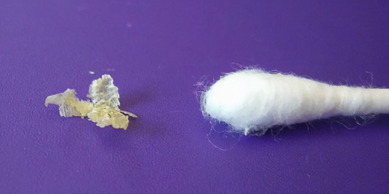 为啥有人"耳屎"是湿的,有的却是干的?或和这件"尴尬事"有关