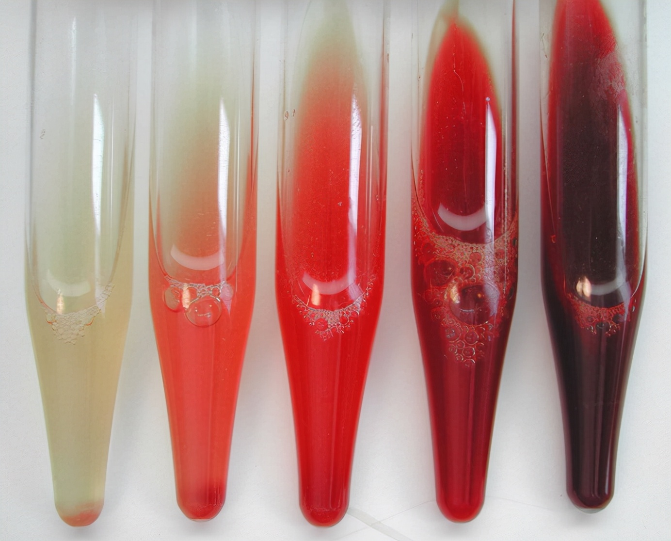 肾脏好不好要看排尿？尿液出现这4种“形态”，要当心肾亮红灯