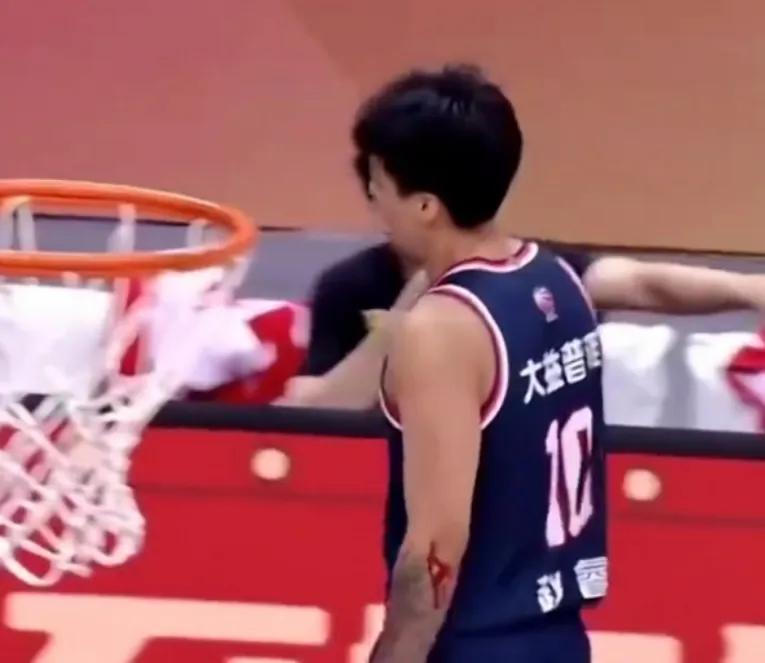 cba比賽為什么電視不轉播（廣東隊消息！體育臺停播真相，趙睿傷口加重，杜鋒執教風格變化！）