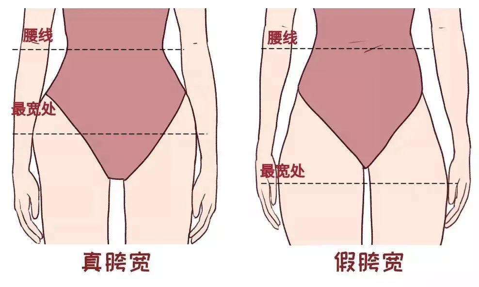 假胯宽和真胯宽图片 假胯宽矫正的正确方法