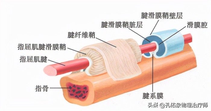 中老年女性常手指疼痛、肿胀，是腱鞘炎吗？该怎么办？告知您