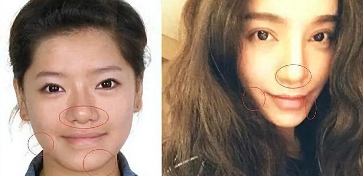 曾是超女冠军,却因整容失败像“怪物”,全身只剩下眼珠是自己的