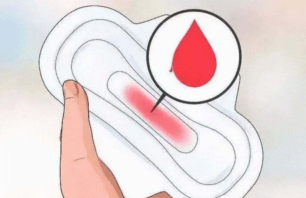 月经血块图片(女性来例假时) - 赤虎壹号