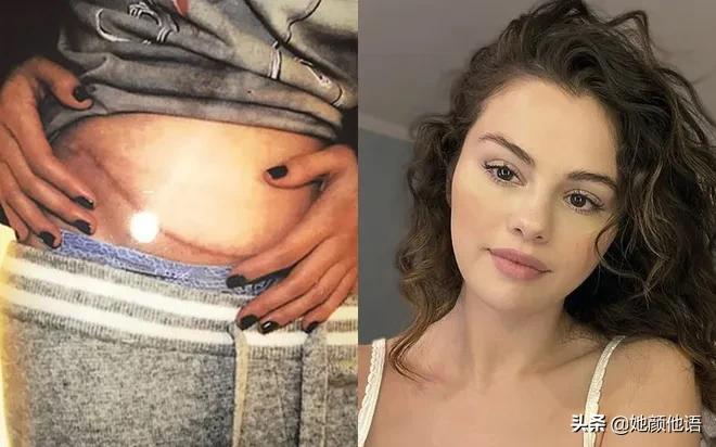 30岁的的塞琳娜·戈麦斯：在与一个情场浪子的恋情后找回微笑