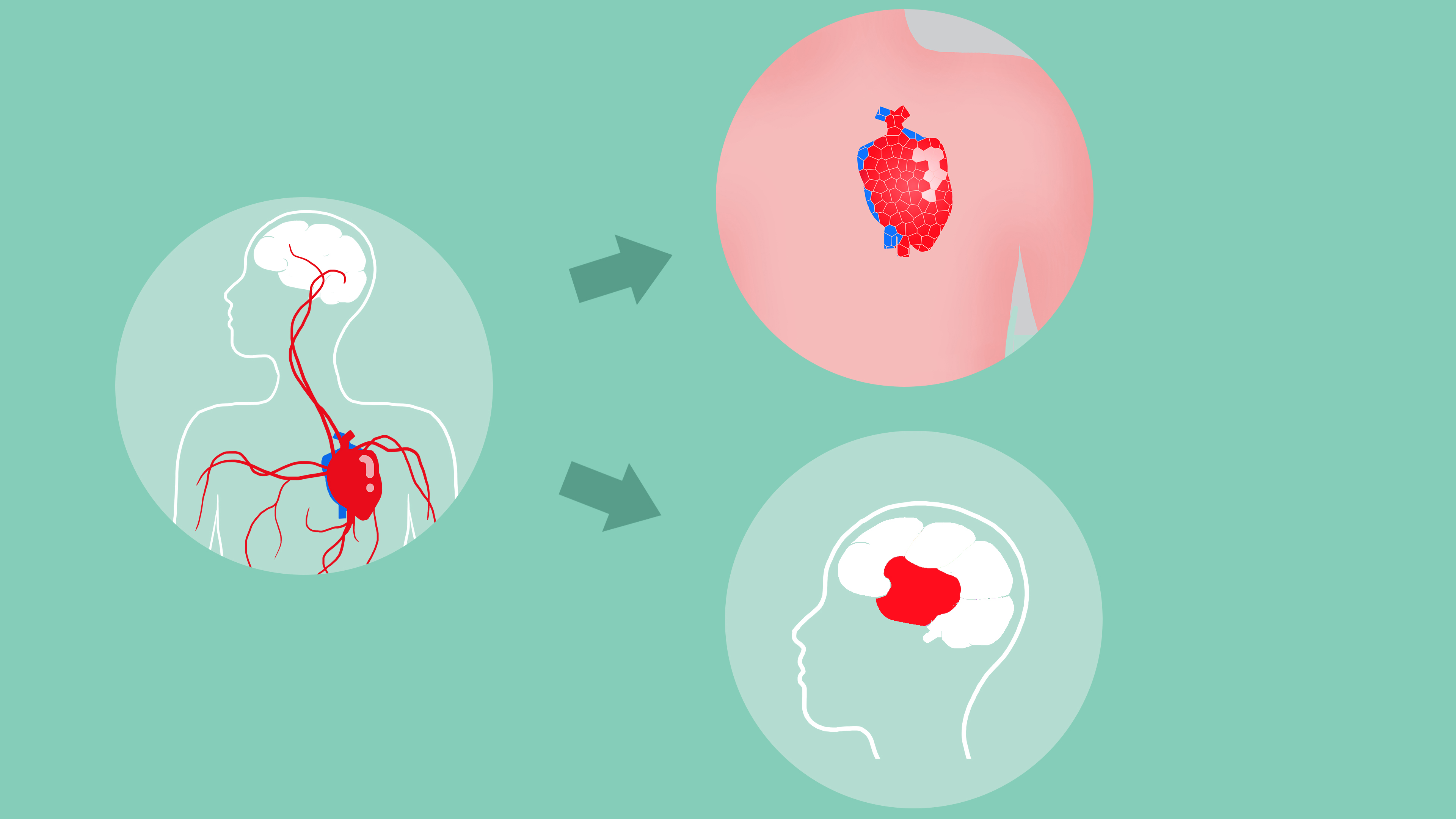 心脑血管病越来越多，哪些因素对血管不利？保护血管的方法请收下