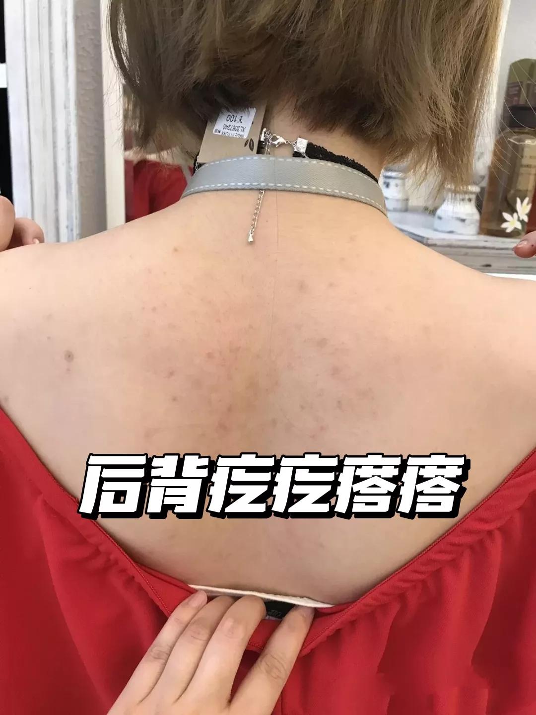 建议女生：坚持四个习惯，短时间变漂亮