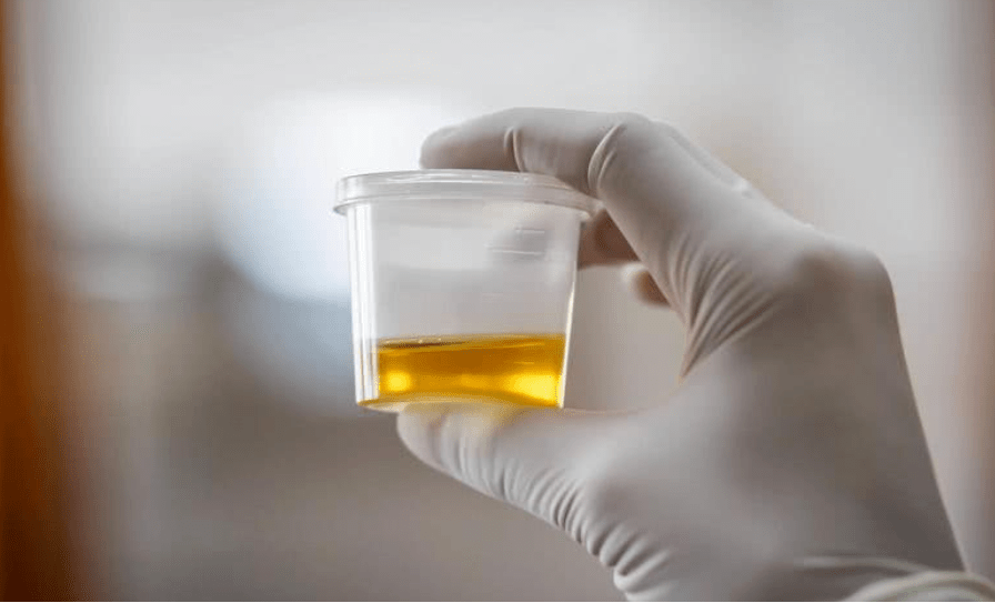 大小便是身体健康的一面镜子，若大小便出现这几种变化，要去检查