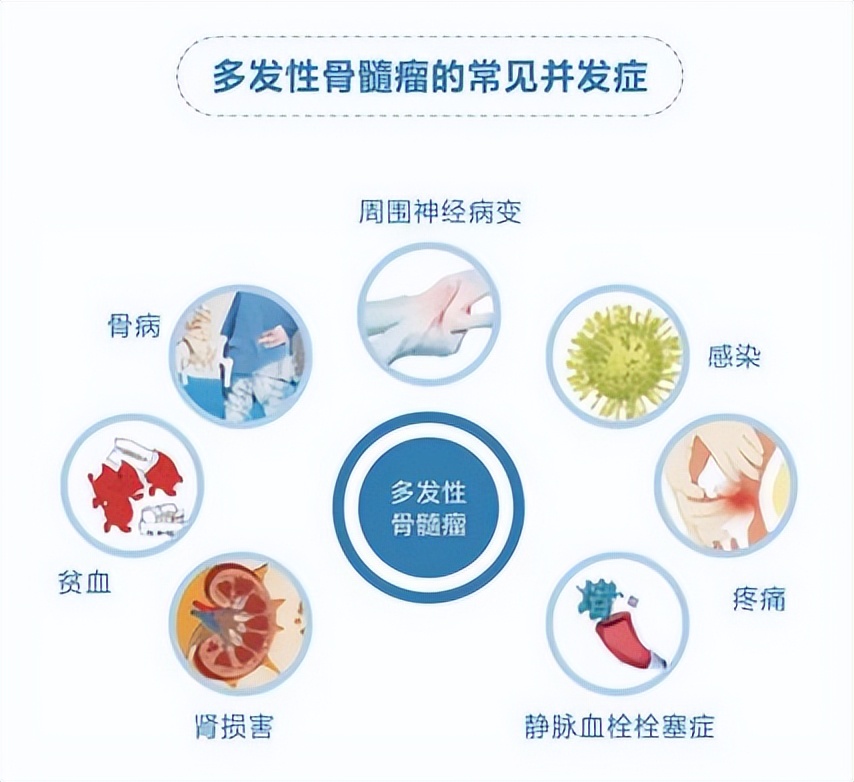全国肿瘤防治宣传周丨狡猾的“多发性骨髓瘤”