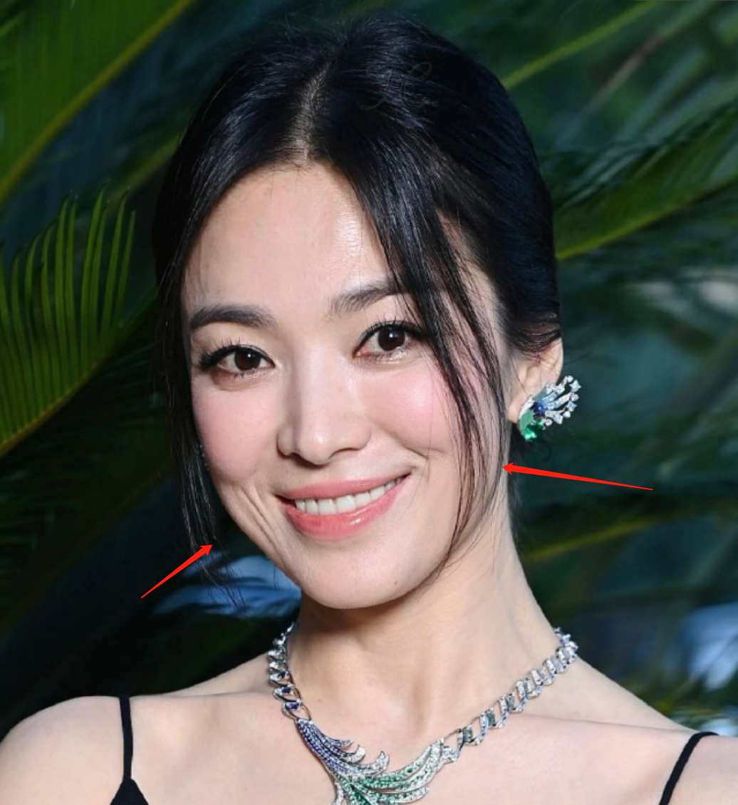 42岁宋慧乔外网生图翻车，法令纹多还地包天，被嘲有点儿凶相