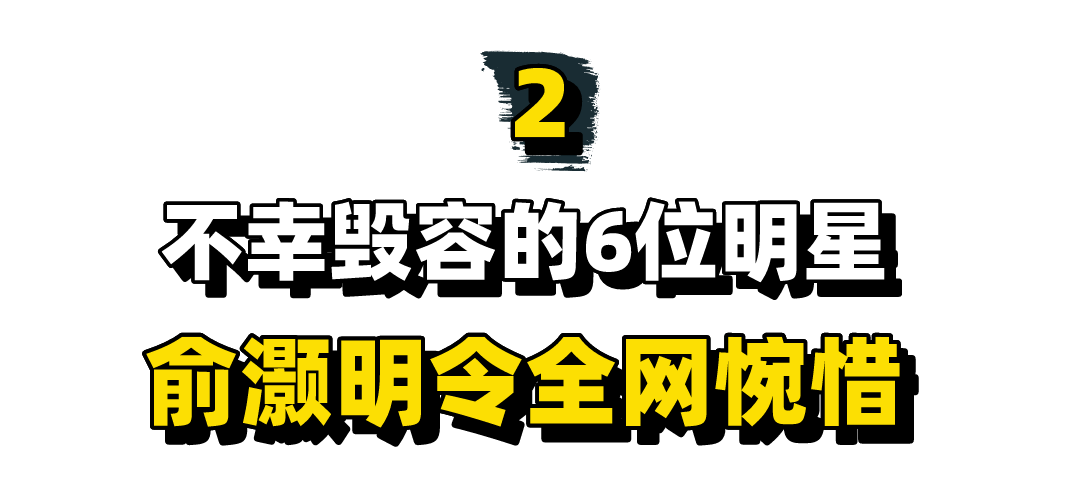 不幸毁容的6位明星：王祖贤女神变大妈，胡歌伤愈复出重回巅峰