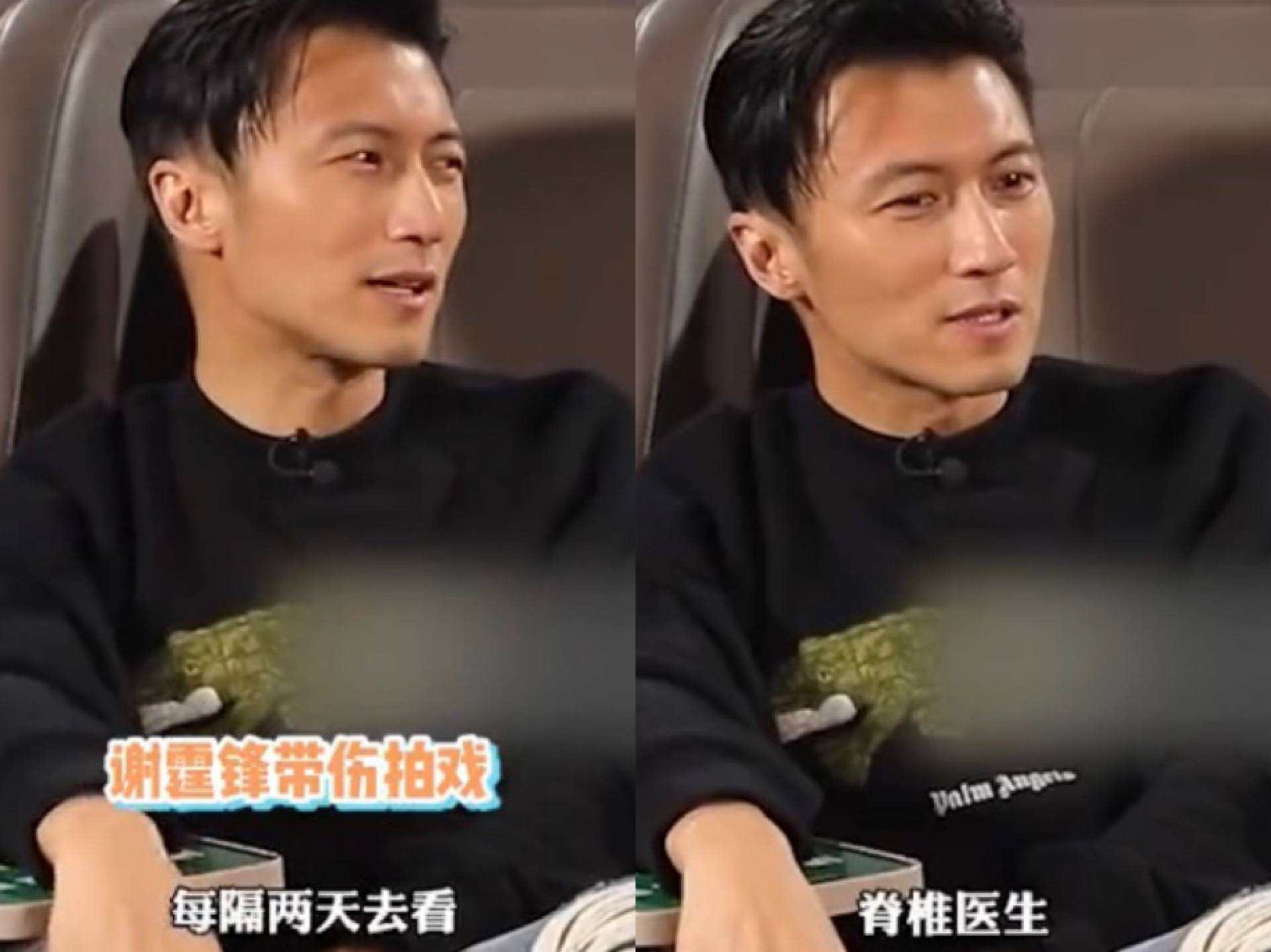 影帝影后多敬业？有人生吞12枚鸡蛋、鼻子被打歪，有人为戏锯门牙