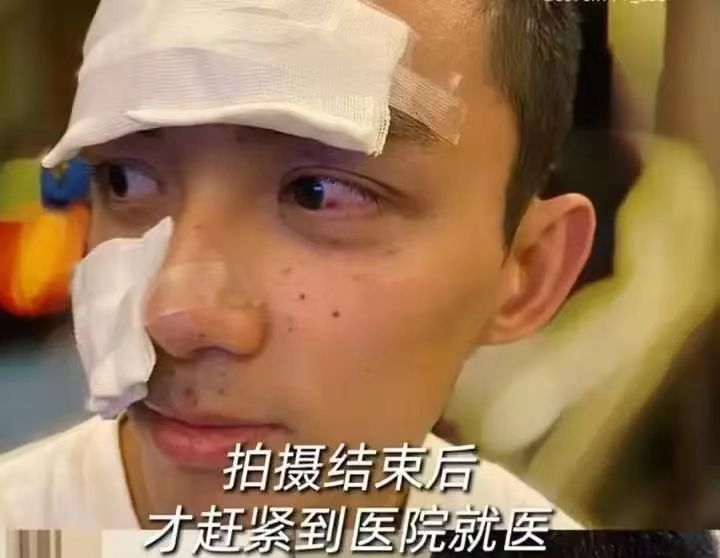 杨幂的眼角，阿娇的脸，明星脸上受伤、毁容，各个让人揪心