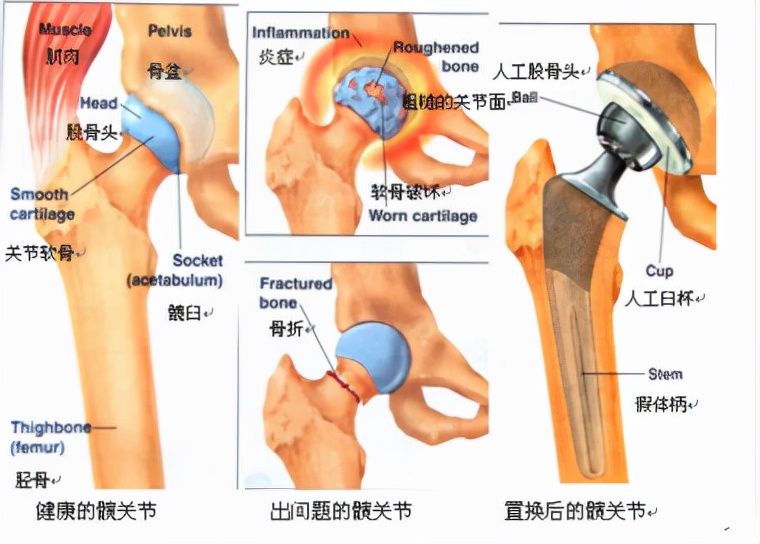 访洪雅国家二级骨科医院院长王春华 倾力打造百姓满意的骨科医院