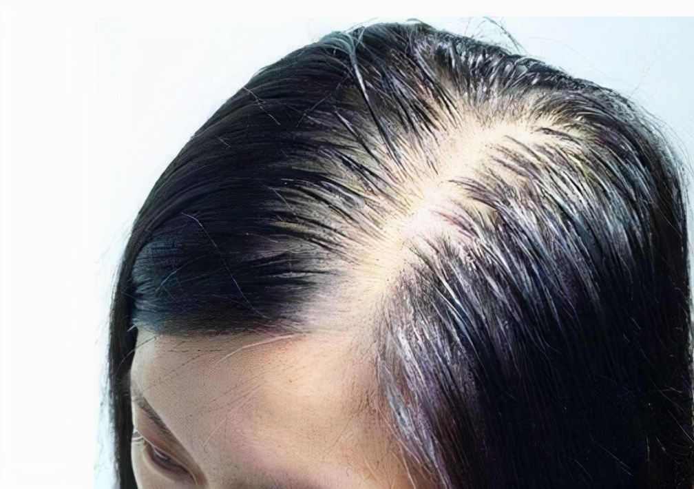 常常吃太咸的东西，会发生什么？提示：身体会出现这几种状况