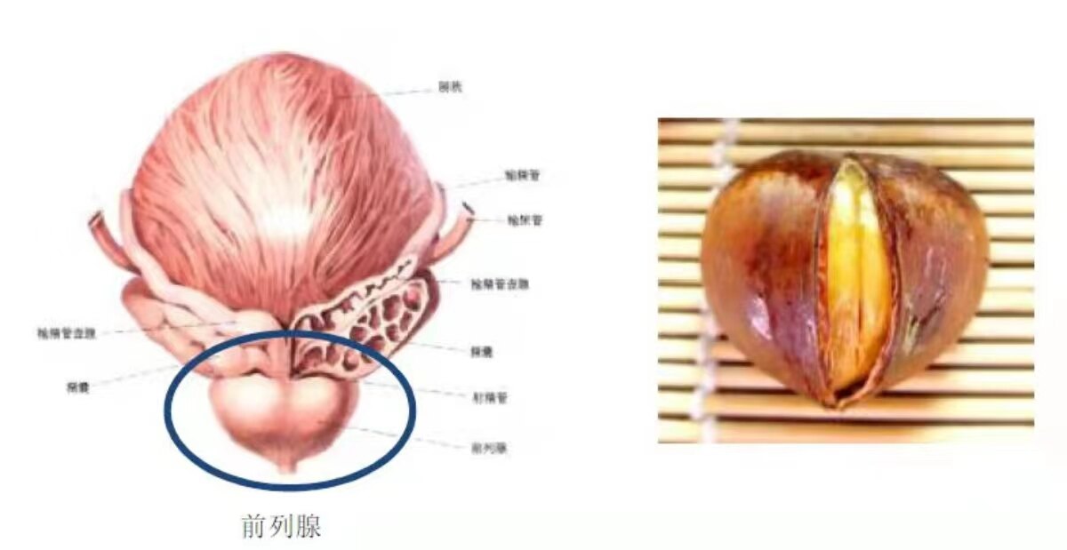 1分钟自测前列腺！掌握“前腺”健康动态！你Get到？