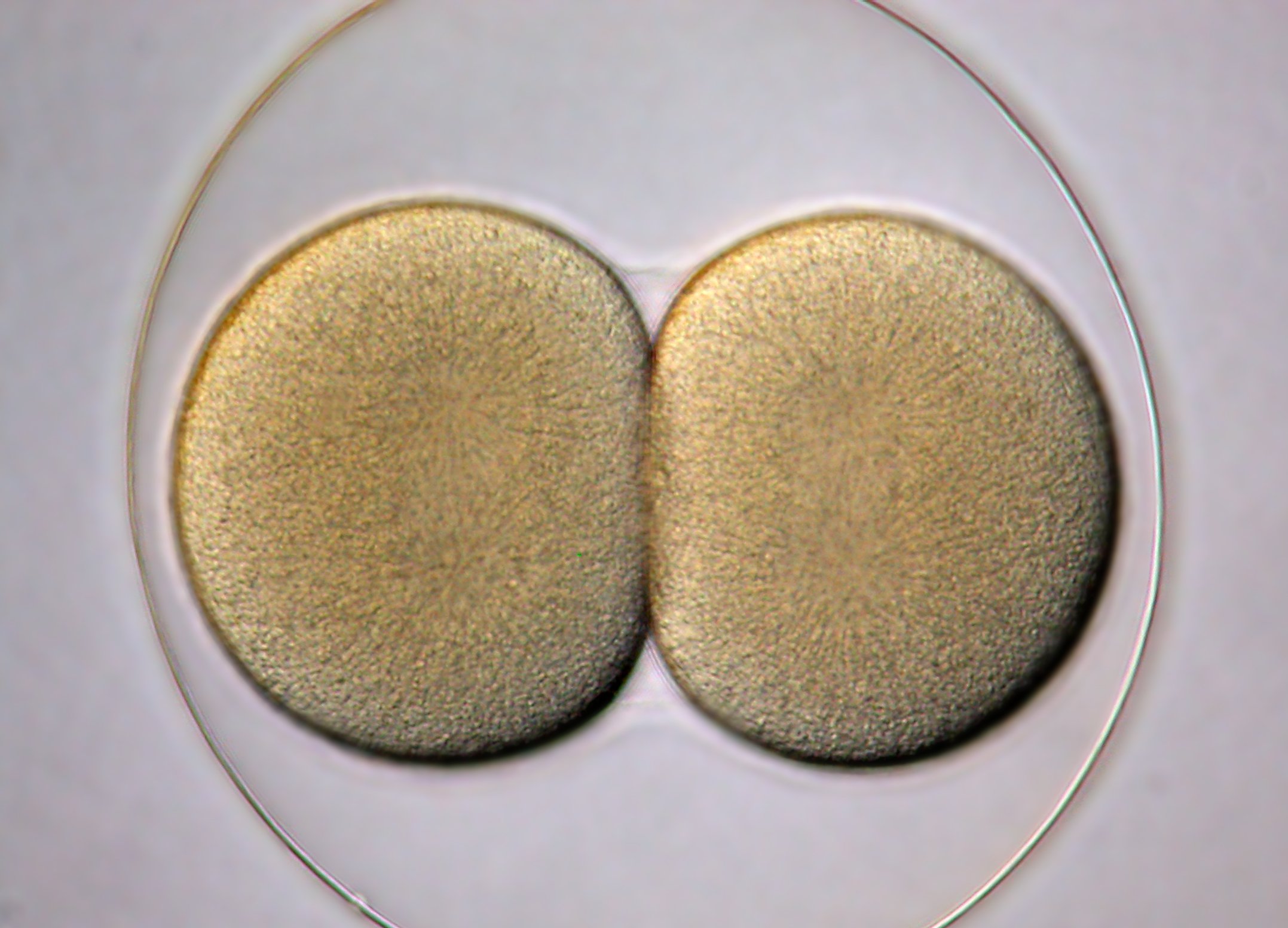 “试管婴儿之父”告诉你，什么样的夫妻适合做试管婴儿？