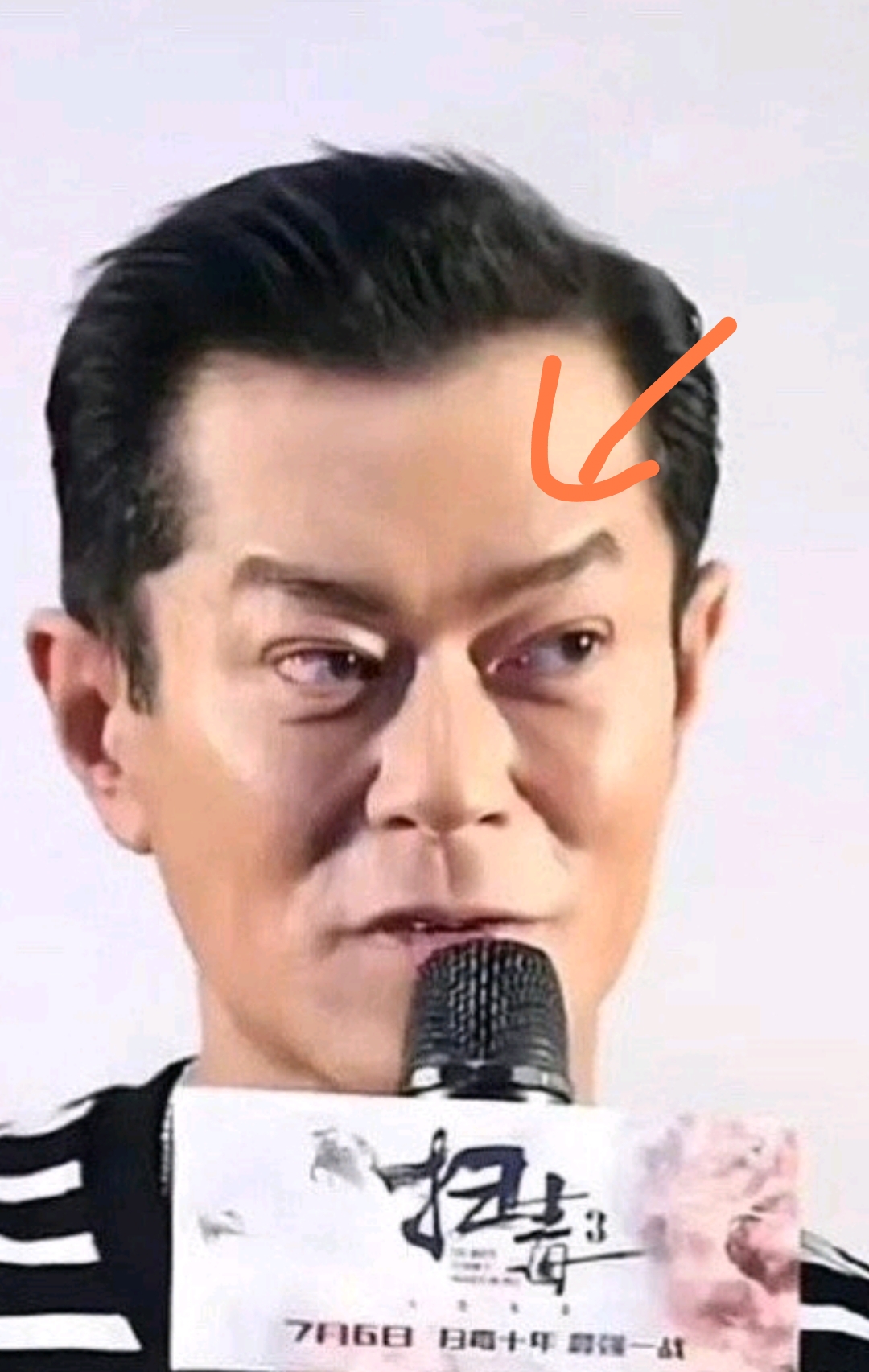 古天乐出席活动惹争议,表情狰狞吊眼角,疑似面部提拉过度出问题