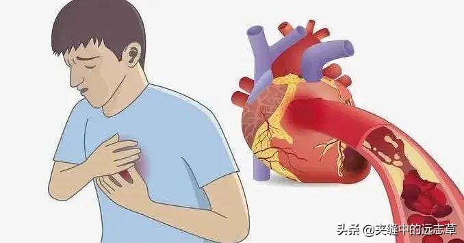 冠心病、高脂血症，多因淤血停，送你味中，血管的清道夫