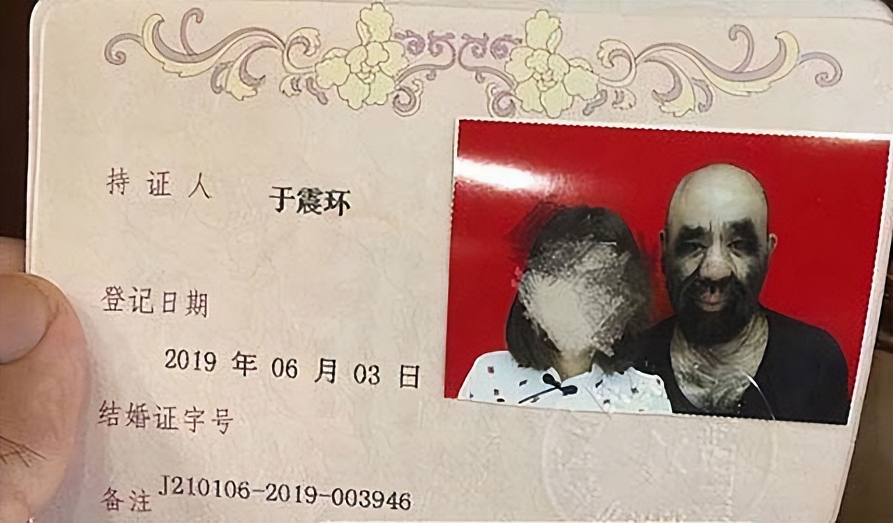 当年轰动一时的“毛孩”：42岁娶90后娇妻，生下一子未遗传长毛